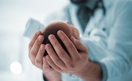 A doctor holding a baby on his forearms, tight focus on the top of the baby's head